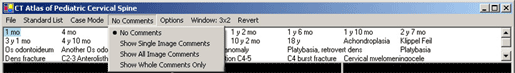 Cervical Spine Atlas Screen Shot 7