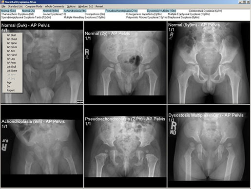 By right-clicking over an image, a drop down menu will let you select various views from the skeletal survey, as well as items such as Age, Diagnosis (Dx), or Report.