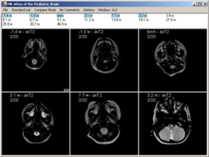 Brain Atlas Screenshot 1