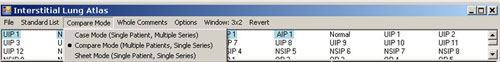 Interstitial Lung Compare Mode