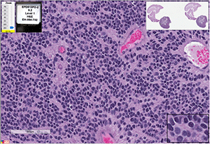 EPD-613FH cells