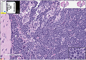 GBM-611FH cells