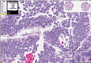 PBT-02FH cells