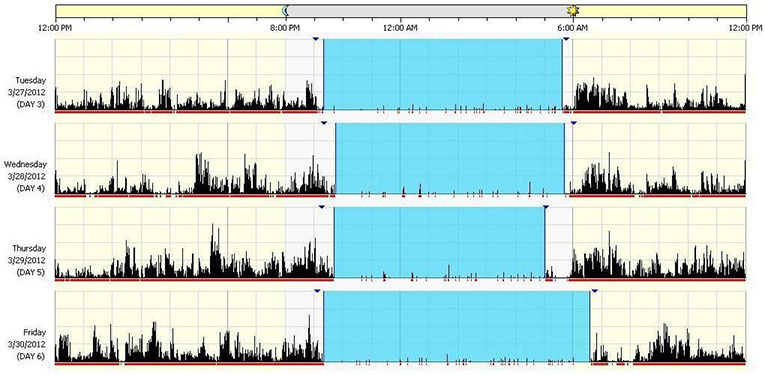 Sample actogram