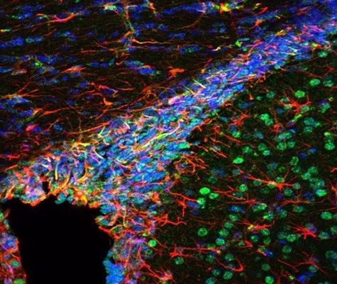 Infographic on identifying neural circuits that integrate breathing with behavior and emotion 